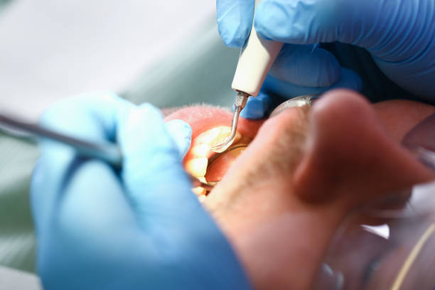 Best Urgent Tooth Repair  in Ball Ground, GA